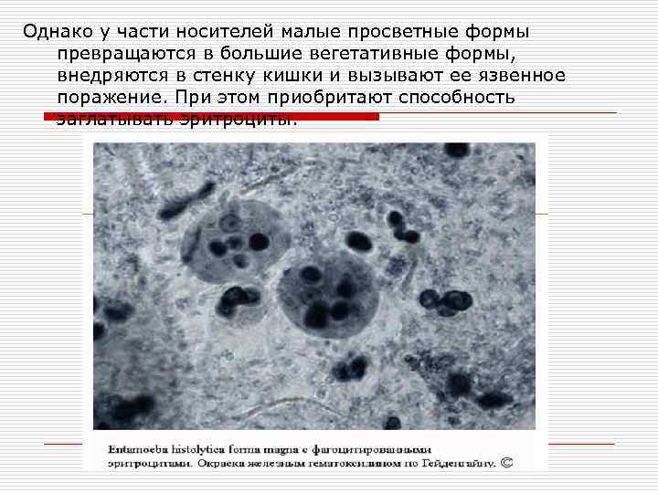 Однако у части носителей малые просветные формы превращаются в большие вегетативные формы, внедряются в
