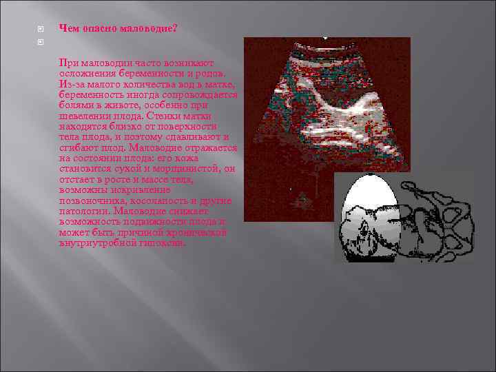  Чем опасно маловодие? При маловодии часто возникают осложнения беременности и родов. Из-за малого