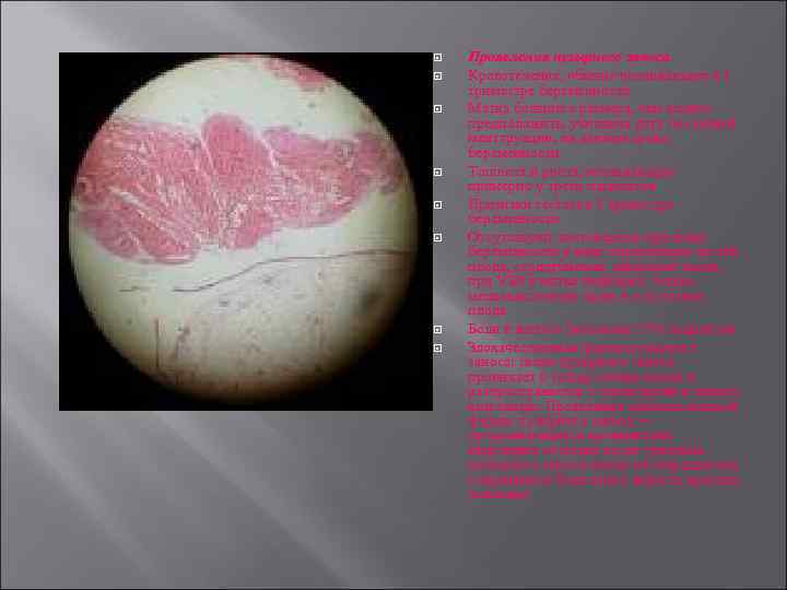  Проявления пузырного заноса Кровотечение, обычно возникающее в I триместре беременности Матка большего размера,