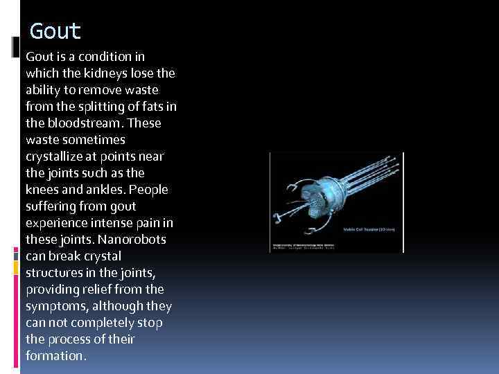 Gout is a condition in which the kidneys lose the ability to remove waste