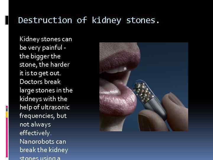 Destruction of kidney stones. Kidney stones can be very painful - the bigger the