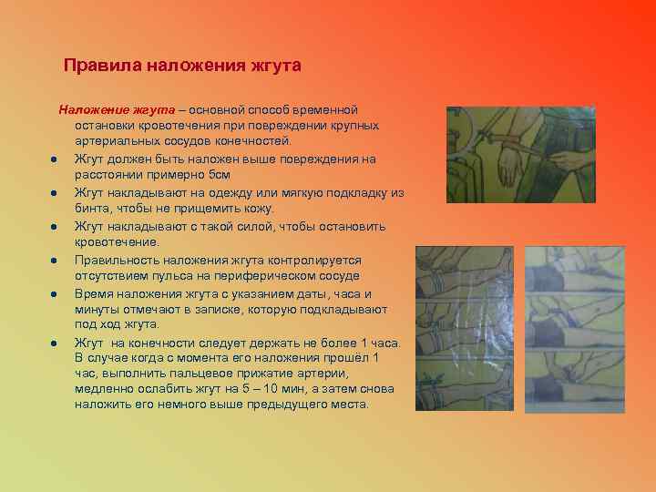 Правила наложения жгута Наложение жгута – основной способ временной остановки кровотечения при повреждении крупных