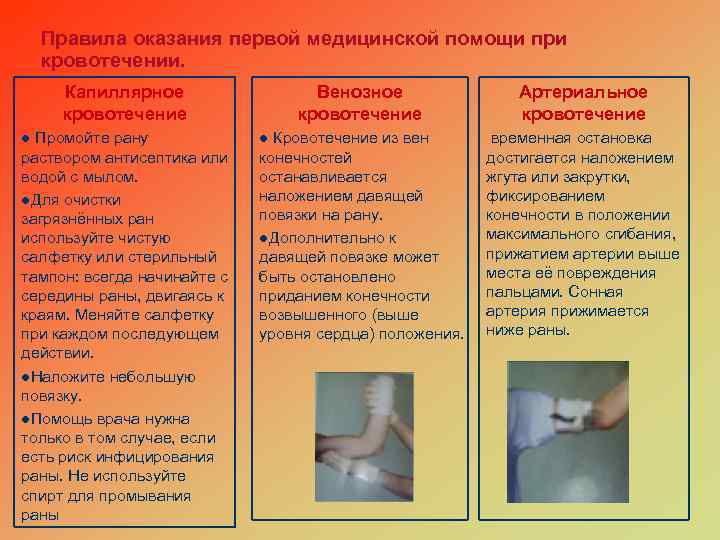 Правила оказания первой медицинской помощи при кровотечении. Капиллярное кровотечение Венозное кровотечение l Промойте рану