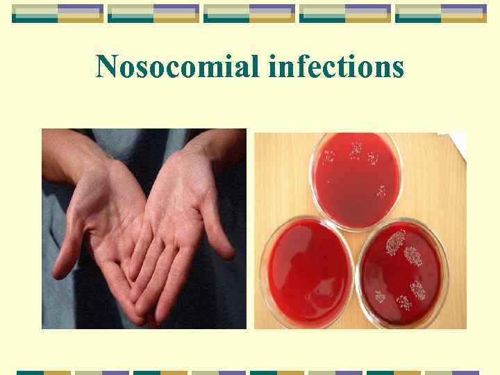 Nosocomial infections 