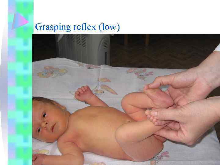 Grasping reflex (low) 