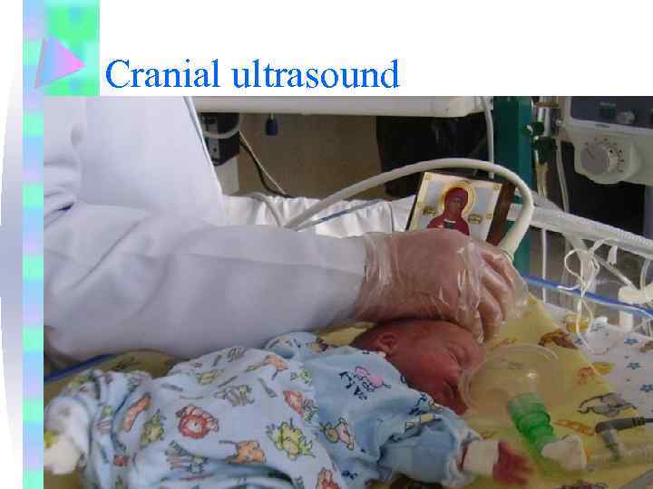 Cranial ultrasound 