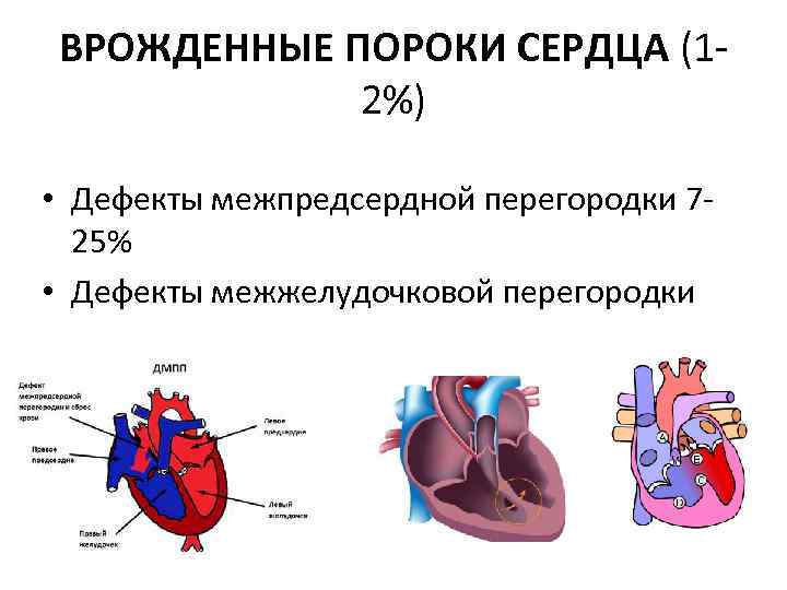 ВРОЖДЕННЫЕ ПОРОКИ СЕРДЦА (12%) • Дефекты межпредсердной перегородки 725% • Дефекты межжелудочковой перегородки 