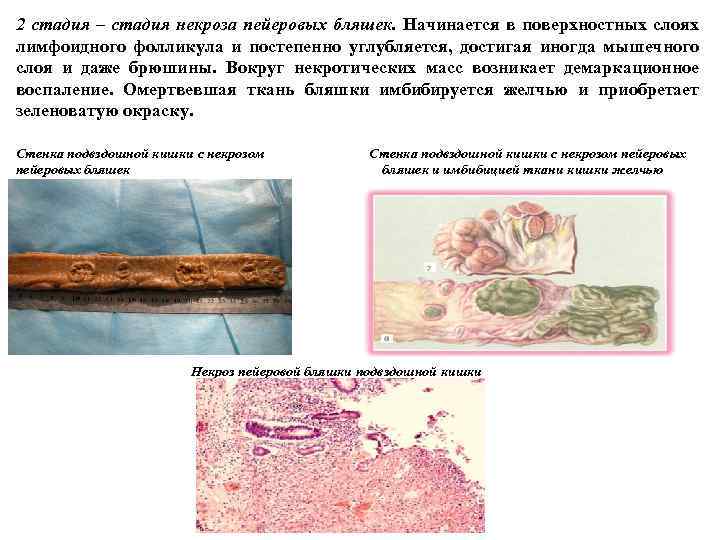 Кишечные инфекции патанатомия презентация