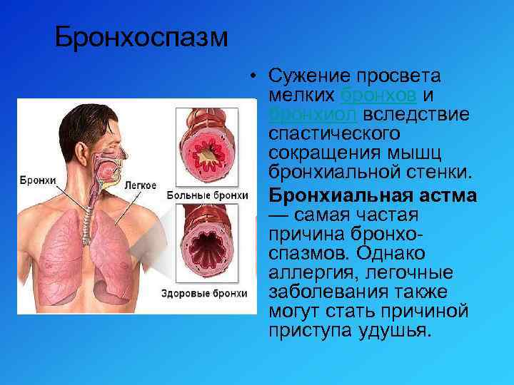 Бронхоспазм • Сужение просвета мелких бронхов и бронхиол вследствие спастического сокращения мышц бронхиальной стенки.