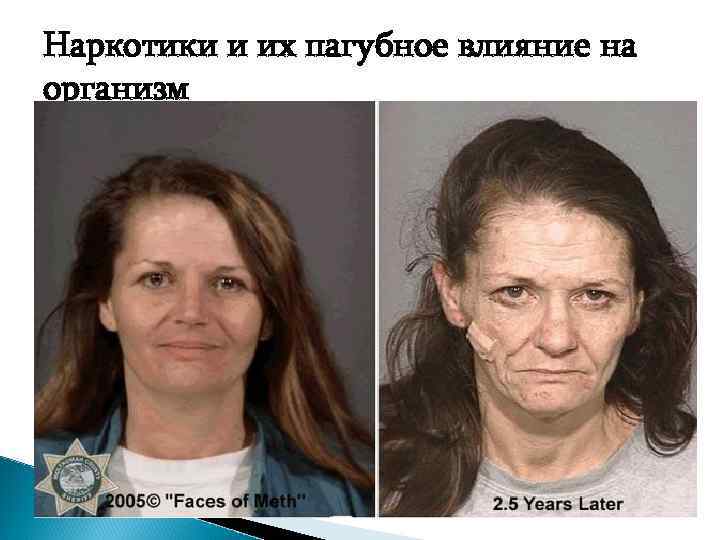 Наркотики и их пагубное влияние на организм 