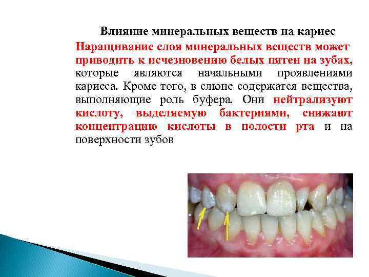 Влияние минеральных веществ на кариес Наращивание слоя минеральных веществ может приводить к исчезновению