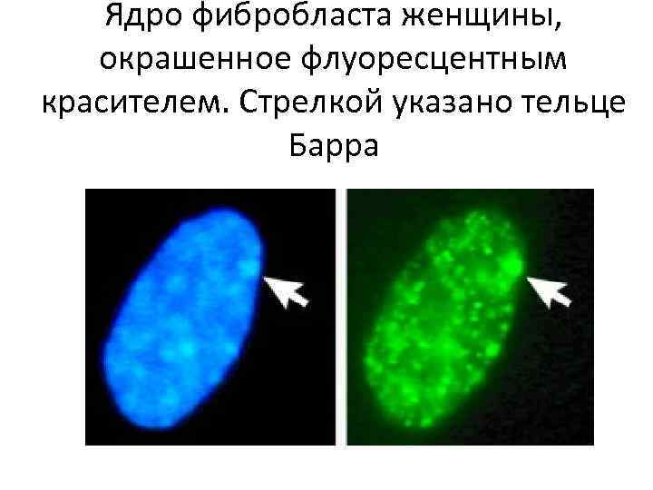 Ядро фибробласта женщины, окрашенное флуоресцентным красителем. Стрелкой указано тельце Барра 