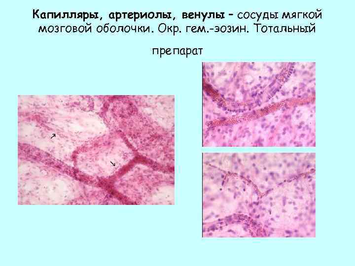 Артерия эластического типа рисунок