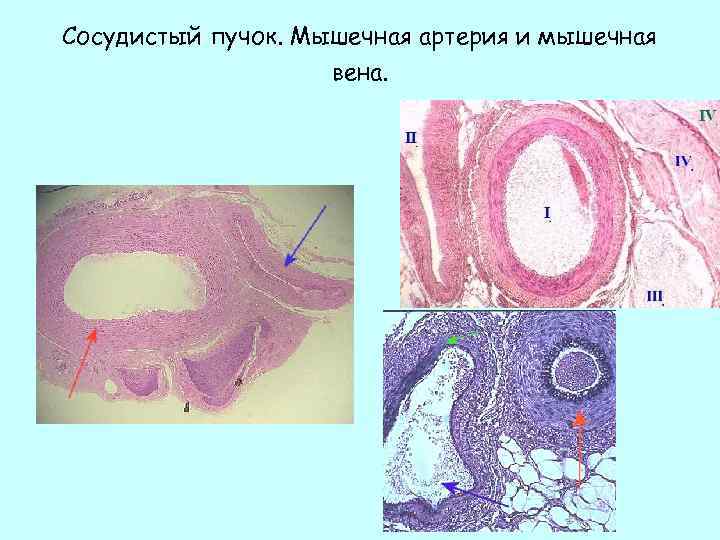 Сосудистые пучки это