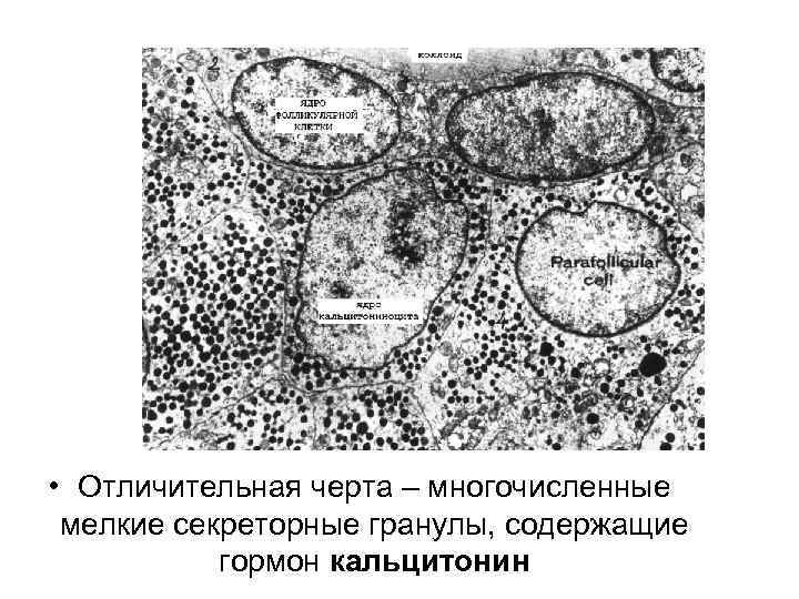  • Отличительная черта – многочисленные мелкие секреторные гранулы, содержащие гормон кальцитонин 