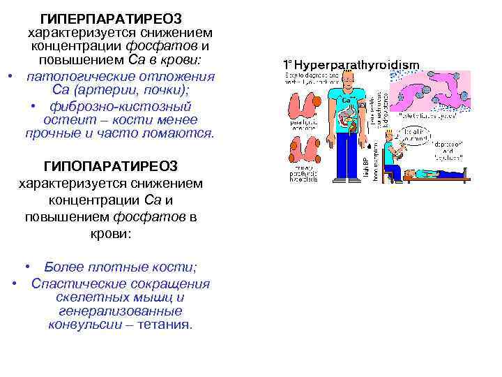 ГИПЕРПАРАТИРЕОЗ характеризуется снижением концентрации фосфатов и повышением Са в крови: • патологические отложения Са