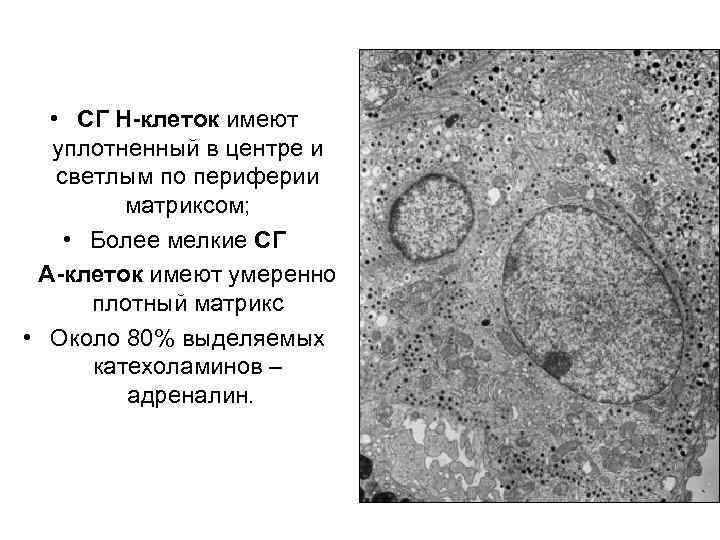  • СГ Н-клеток имеют уплотненный в центре и светлым по периферии матриксом; •