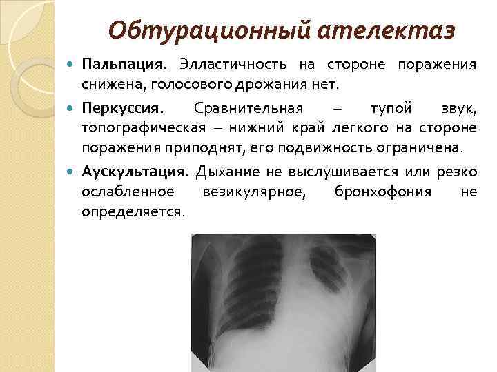 Обтурационный ателектаз Пальпация. Элластичность на стороне поражения снижена, голосового дрожания нет. Перкуссия. Сравнительная –