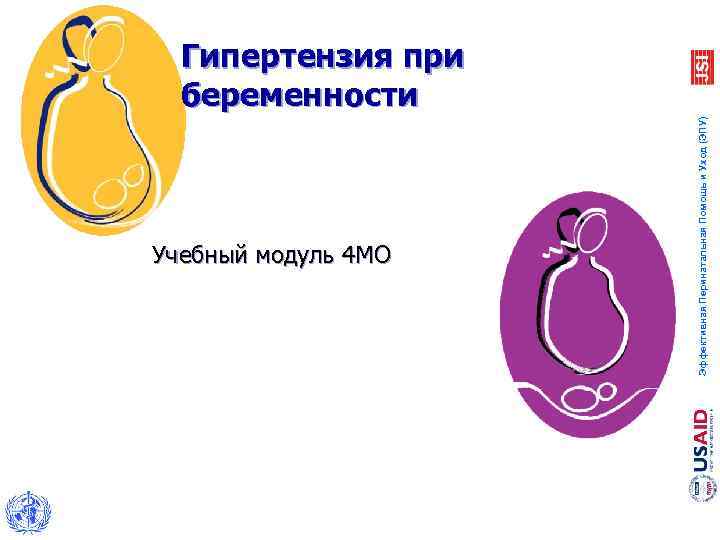 Учебный модуль 4 MO Эффективная Перинатальная Помощь и Уход (ЭПУ) Гипертензия при беременности 