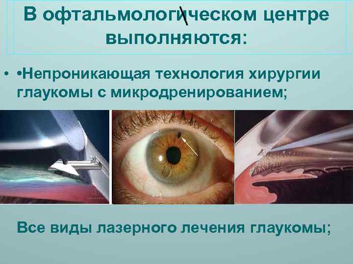 В офтальмологическом центре  выполняются: • • Непроникающая технология хирургии глаукомы с микродренированием; Все