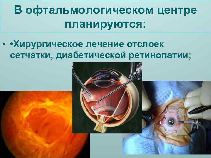 В офтальмологическом центре планируются: • • Хирургическое лечение отслоек сетчатки, диабетической ретинопатии; 