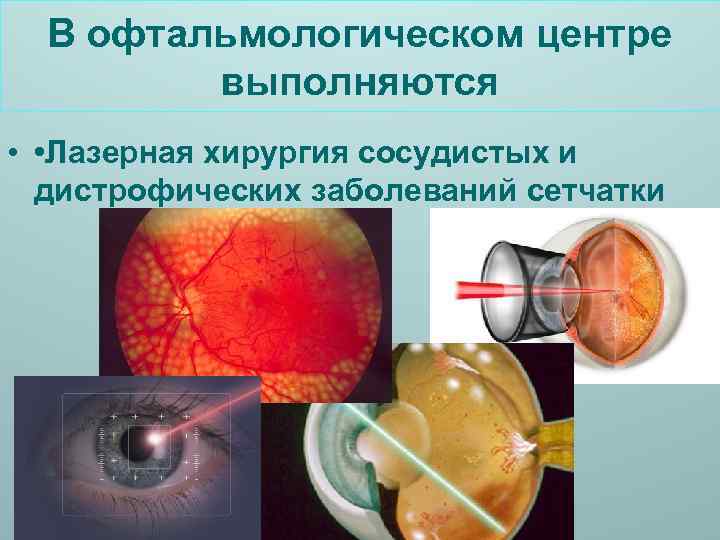 В офтальмологическом центре выполняются • • Лазерная хирургия сосудистых и дистрофических заболеваний сетчатки 