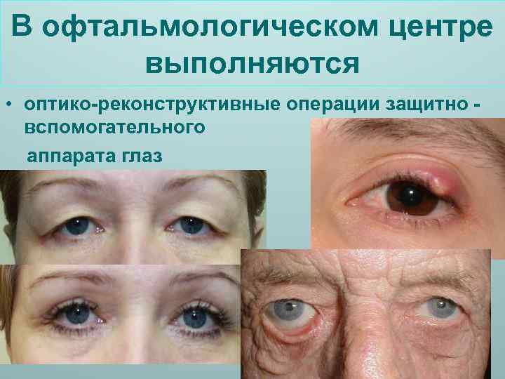 В офтальмологическом центре выполняются • оптико-реконструктивные операции защитно вспомогательного аппарата глаз 