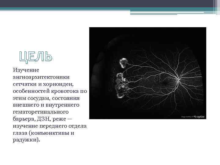 ЦЕЛЬ Изучение ангиоархитектоники сетчатки и хориоидеи, особенностей кровотока по этим сосудам, состояния внешнего и