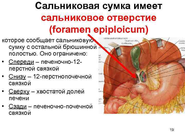 Сальниковая сумка имеет сальниковое отверстие (foramen epiploicum) которое сообщает сальниковую сумку с остальной брюшинной