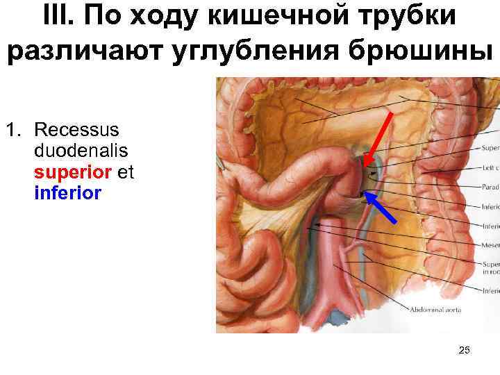 III. По ходу кишечной трубки различают углубления брюшины 1. Recessus duodenalis superior et inferior