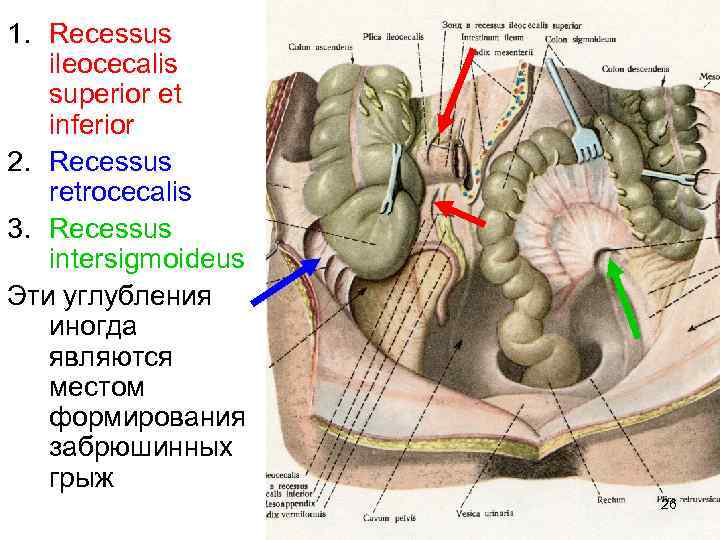 1. Recessus ileocecalis superior et inferior 2. Recessus retrocecalis 3. Recessus intersigmoideus Эти углубления