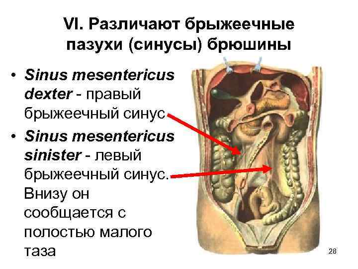 VI. Различают брыжеечные пазухи (синусы) брюшины • Sinus mesentericus dexter - правый брыжеечный синус