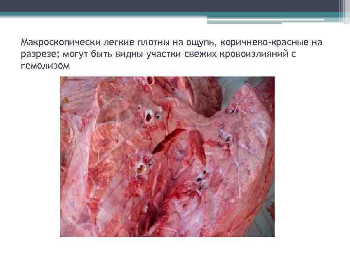Макроскопически легкие плотны на ощупь, коричнево-красные на разрезе; могут быть видны участки свежих кровоизлияний