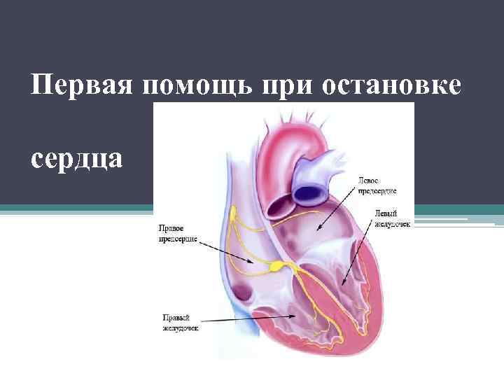 Первая помощь при остановке сердца 