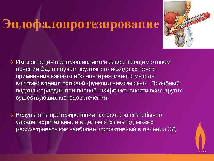 Эндофалопротезирование Ø Имплантация протезов является завершающим этапом лечения ЭД, в случае неудачного исхода которого