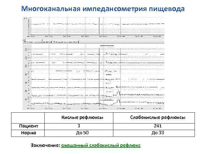 Многоканальная импедансометрия пищевода Кислые рефлюксы Пациент Норма Слабокислые рефлюксы 3 До 50 241 До