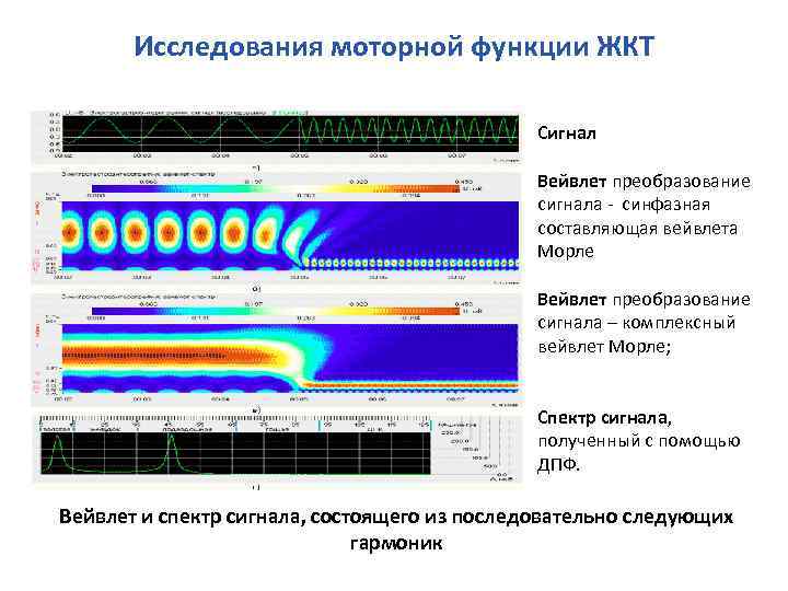 Исследования моторной функции ЖКТ Сигнал Вейвлет преобразование сигнала синфазная составляющая вейвлета Морле Вейвлет преобразование