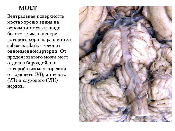 МОСТ Вентральная поверхность моста хорошо видна на основании мозга в виде белого тяжа, в