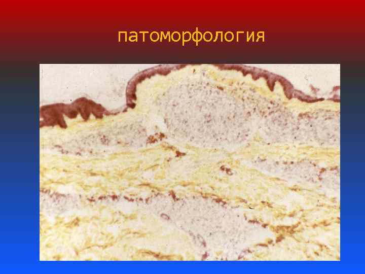 патоморфология 