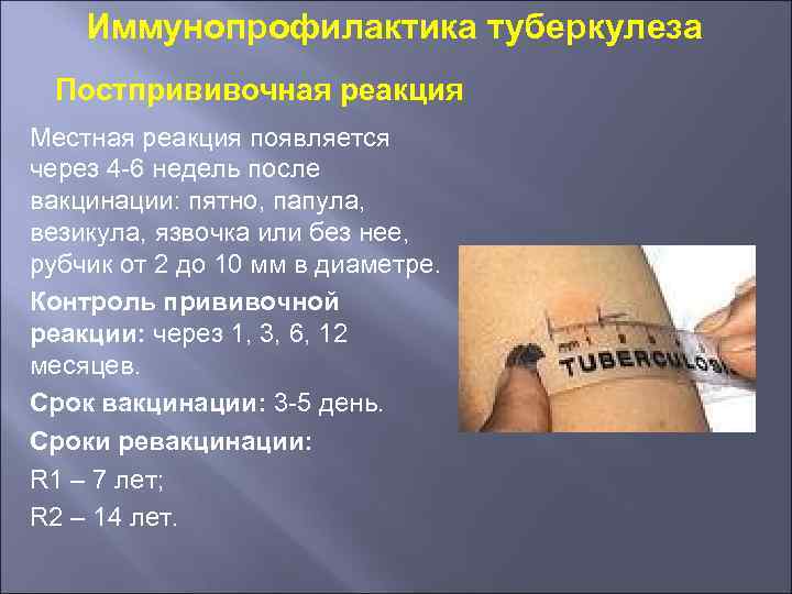 Иммунопрофилактика туберкулеза Постпрививочная реакция Местная реакция появляется через 4 -6 недель после вакцинации: пятно,