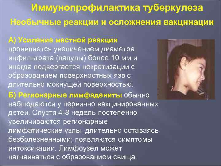 Иммунопрофилактика туберкулеза Необычные реакции и осложнения вакцинации А) Усиление местной реакции проявляется увеличением диаметра