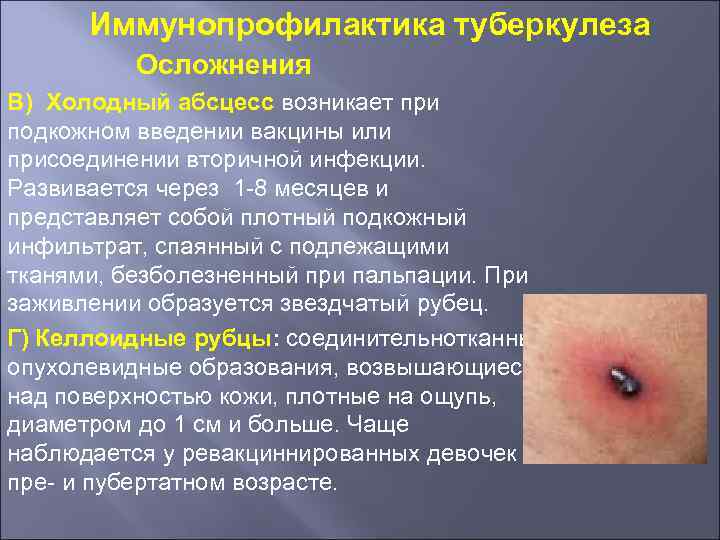 Иммунопрофилактика туберкулеза Осложнения В) Холодный абсцесс возникает при подкожном введении вакцины или присоединении вторичной