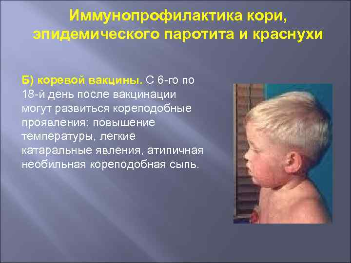 Иммунопрофилактика кори, эпидемического паротита и краснухи Б) коревой вакцины. С 6 -го по 18