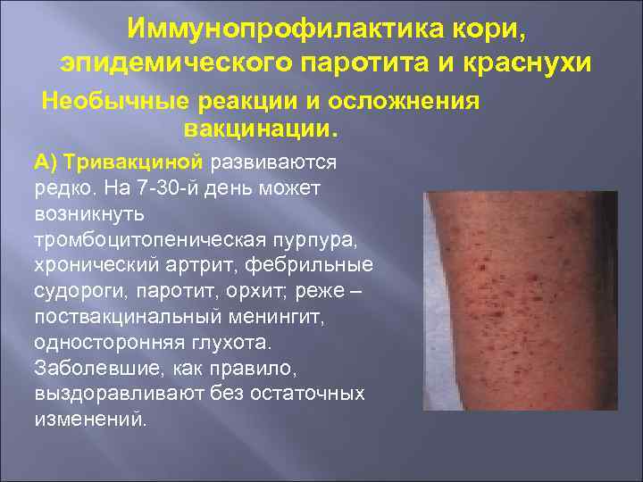 Иммунопрофилактика кори, эпидемического паротита и краснухи Необычные реакции и осложнения вакцинации. А) Тривакциной развиваются