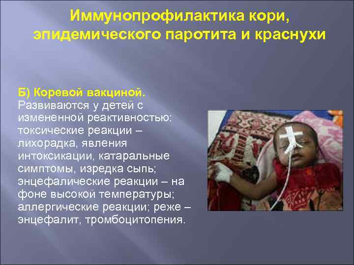 Иммунопрофилактика кори, эпидемического паротита и краснухи Б) Коревой вакциной. Развиваются у детей с измененной