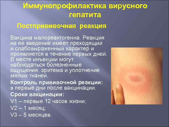 Иммунопрофилактика вирусного гепатита Постпрививочная реакция Вакцина малореактогенна. Реакция на ее введение имеет преходящий и