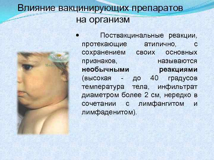 Влияние вакцинирующих препаратов на организм Поствакцинальные реакции, протекающие атипично, с сохранением своих основных признаков,