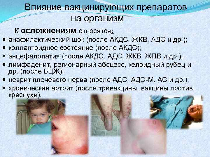 Влияние вакцинирующих препаратов на организм К осложнениям относятся: анафилактический шок (после АКДС. ЖКВ, АДС