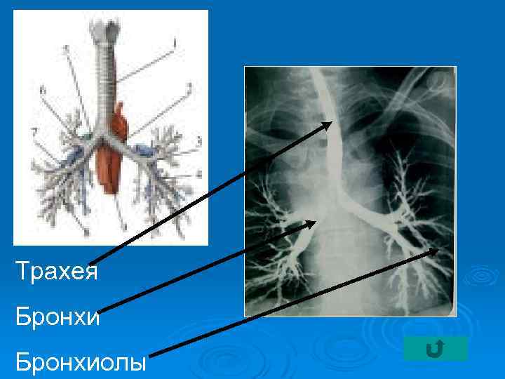 Трахея Бронхиолы 