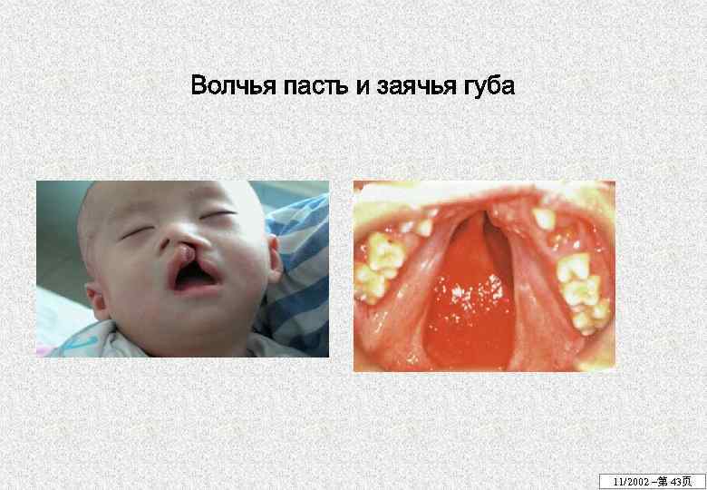 Волчья пасть и заячья губа 11/2002 –第 43页 